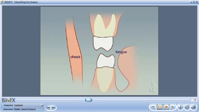 Dental Occlusion Definition Dental Occlusion Definition