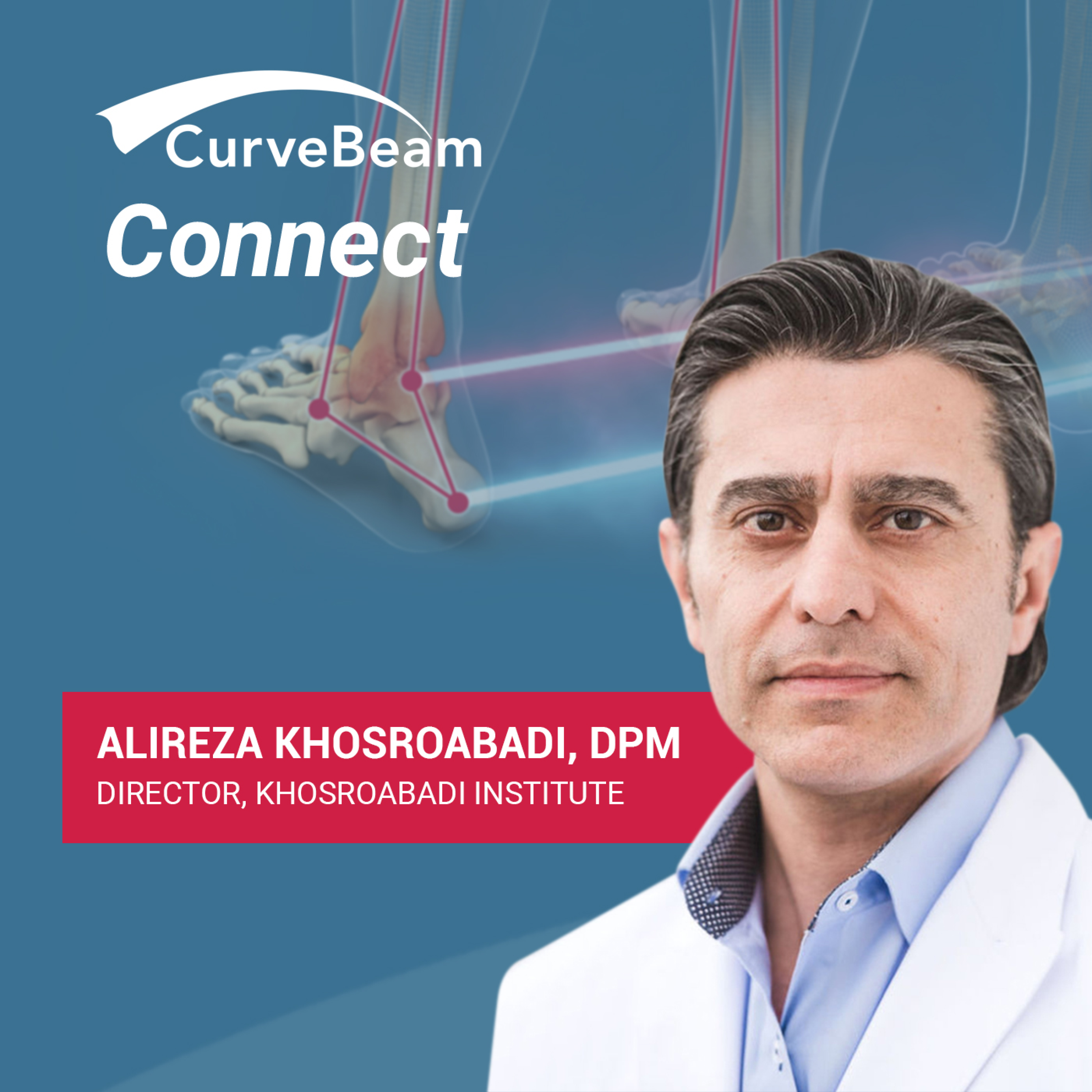 CurveBeam AI Cast