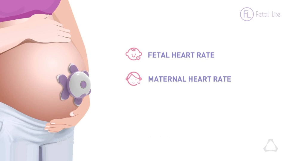 InnAccel Leverages Altair OptiStruct for Validating Fetal Monitoring System