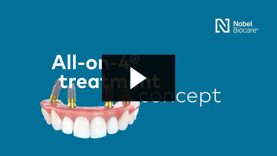 All-on-4 dental implants 