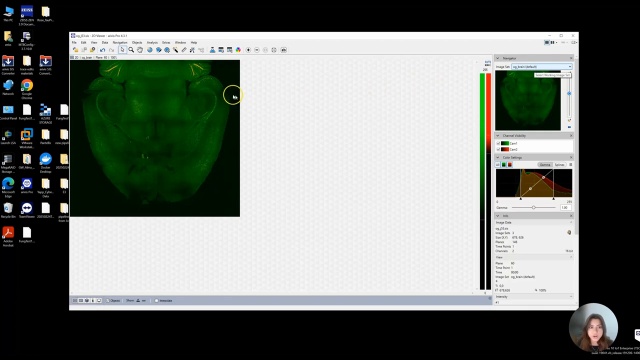 Tutorial: 3D Brain atlas registration in arivis Pro