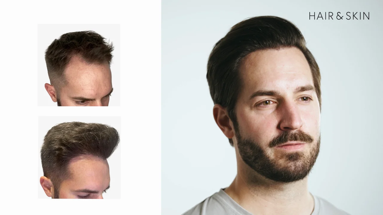 Experte in Haar- und Hautbehandlungen | Ab CHF 40.–/Monat Experte in Haar- und Hautbehandlungen | Ab CHF 40.–/Monat