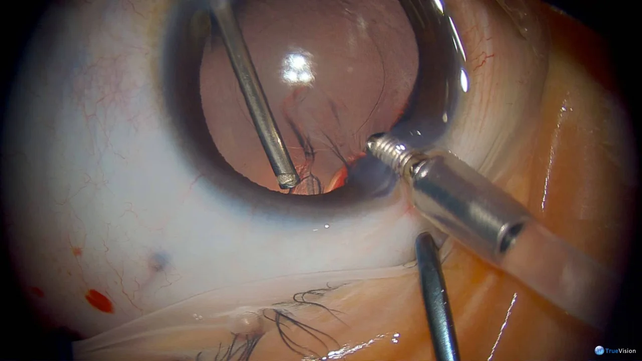 Wistia video thumbnail