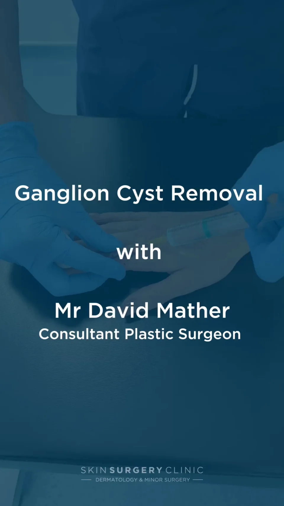 Ganglion Cyst removal