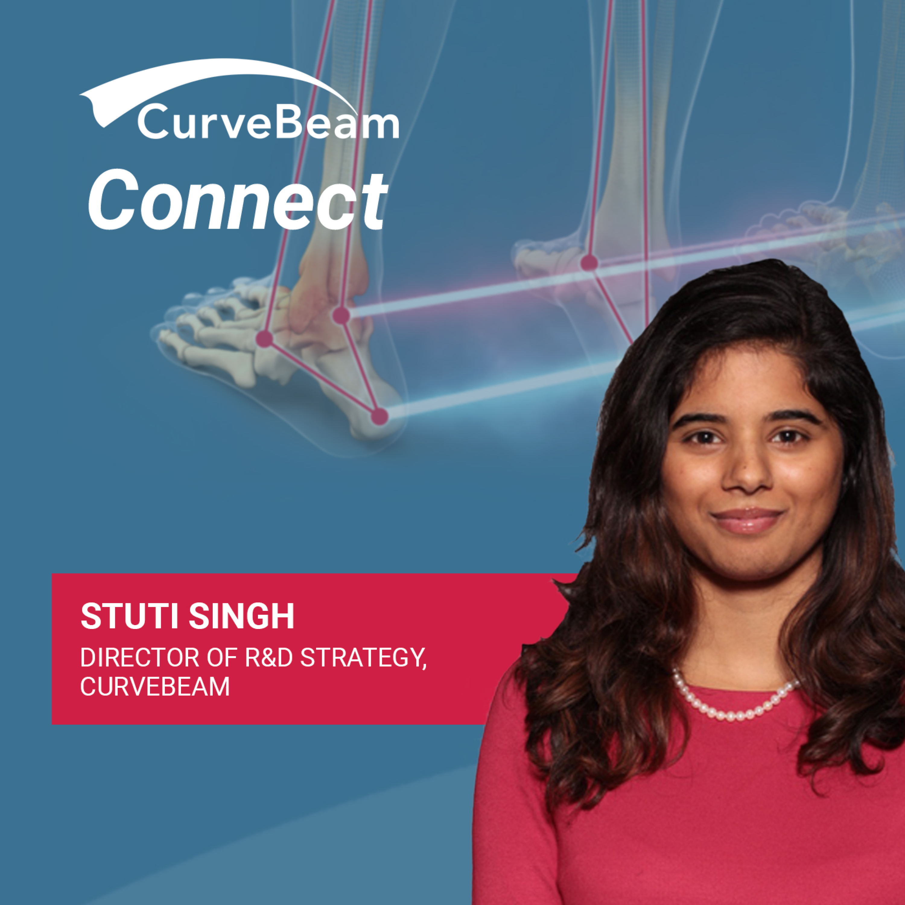 CurveBeam AI Cast
