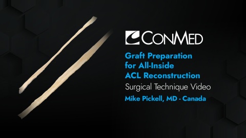 Dr. Pickell - Graft Prep for All-Inside ACL Reconstruction