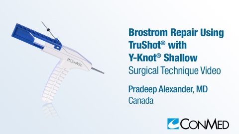 Dr. Alexander - Brostrom Repair Using TruShot® with Y-Knot® Shallow