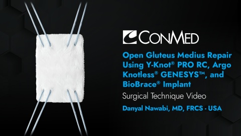 Dr. Nawabi - Open Gluteus Medius Repair Using Y-Knot® PRO RC, Argo Knotless® Genesys™, and BioBrace®