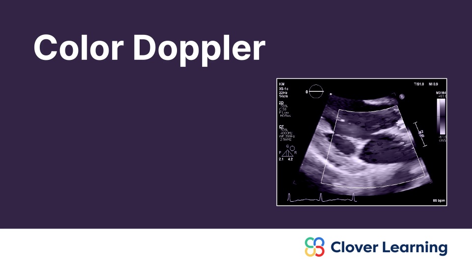 Color Doppler | Video Lesson | Clover Learning