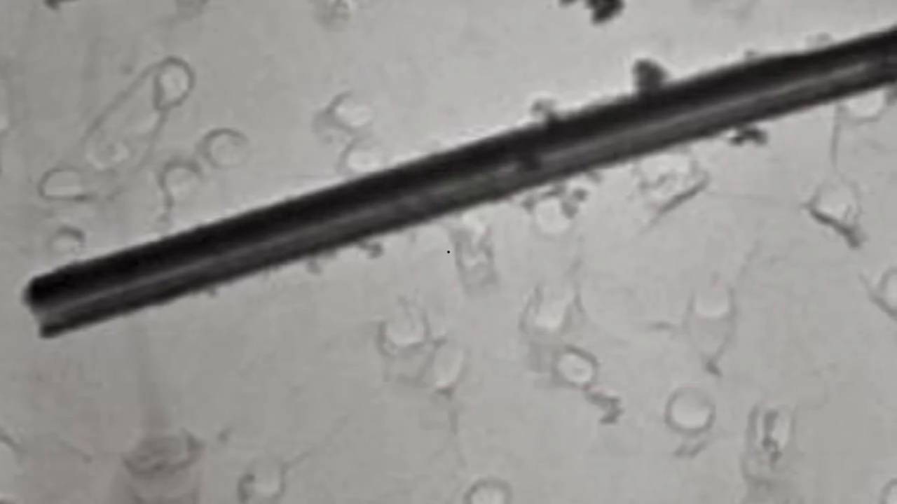Andrea Schwartz-Thomas Video video thumbnail