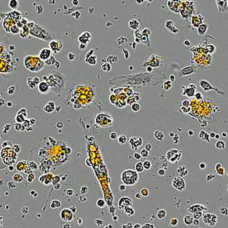 IncuCyte Phagocytosis Assay