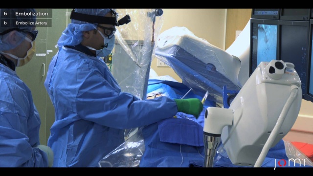 pae prostate cost pae prostate cost