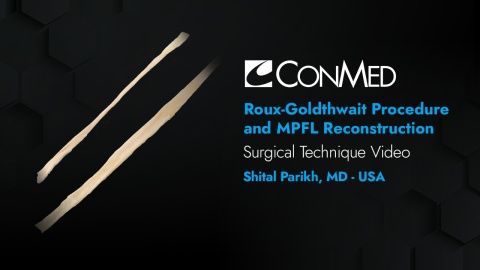 Dr. Parikh - Roux-Goldwaith Technique and MPFL Reconstruction