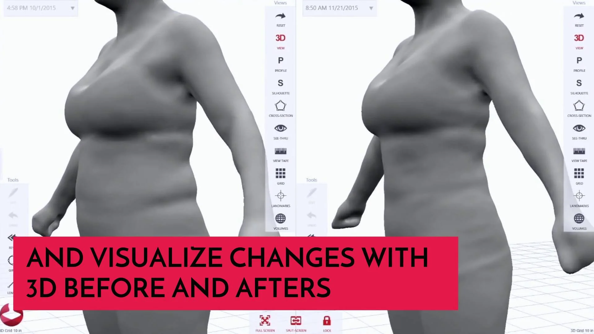 Styku S100システム 3Dボディスキャナー