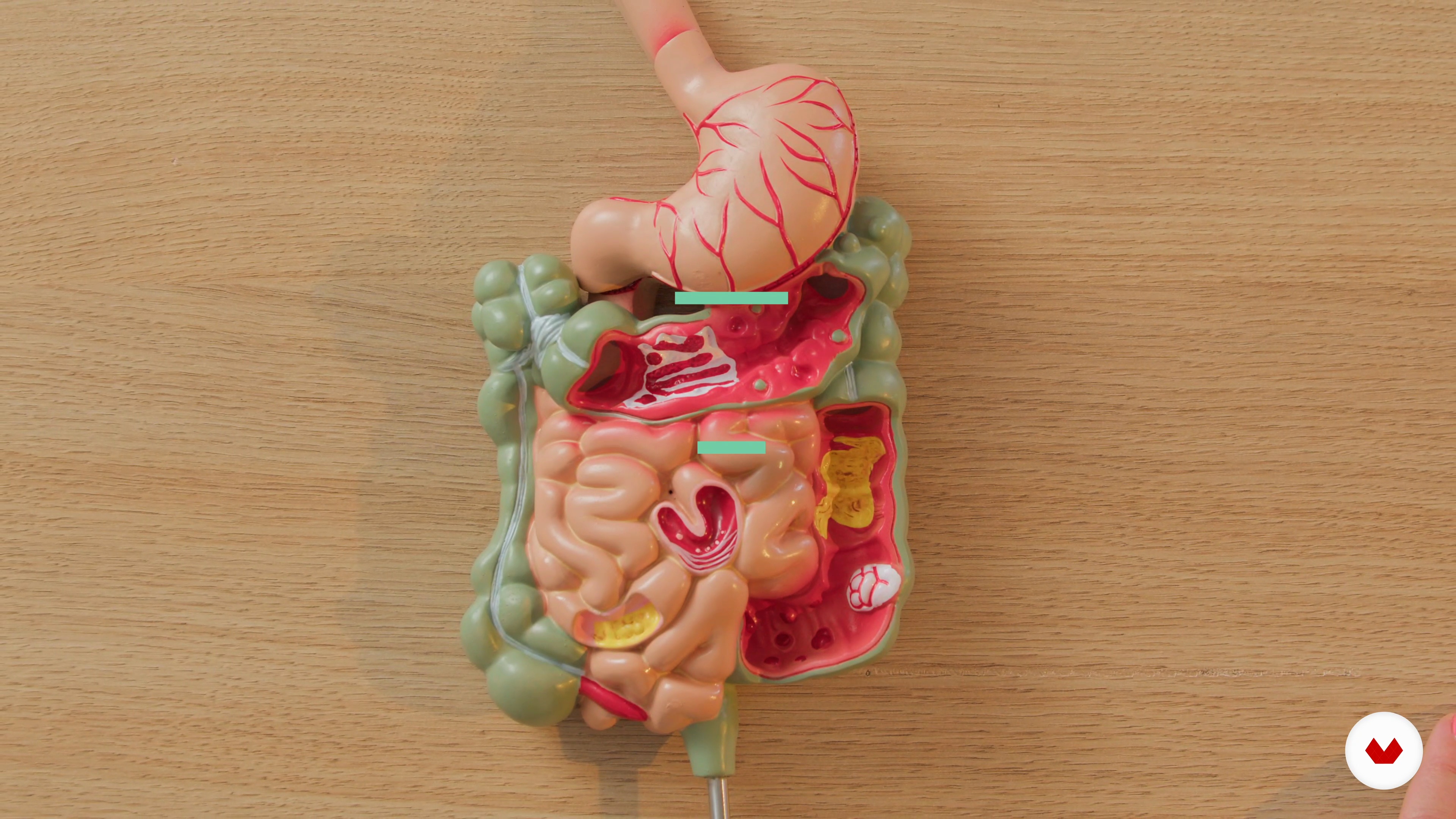 The Gut-Brain Axis Explained
