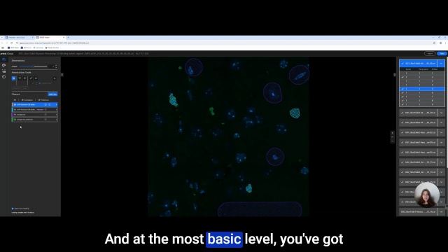 Tutorial: custom cell detection using arivis Cloud