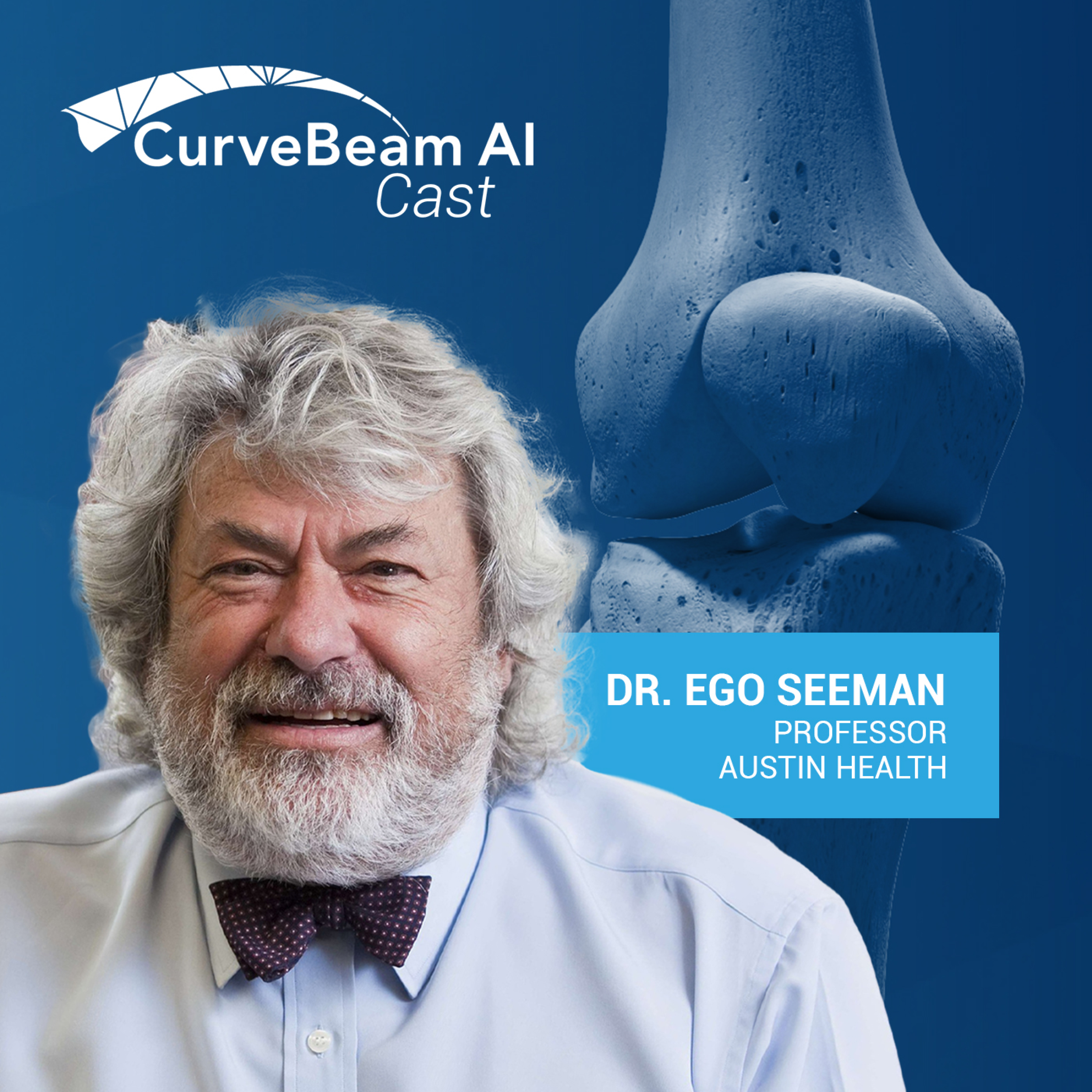 CurveBeam AI Cast