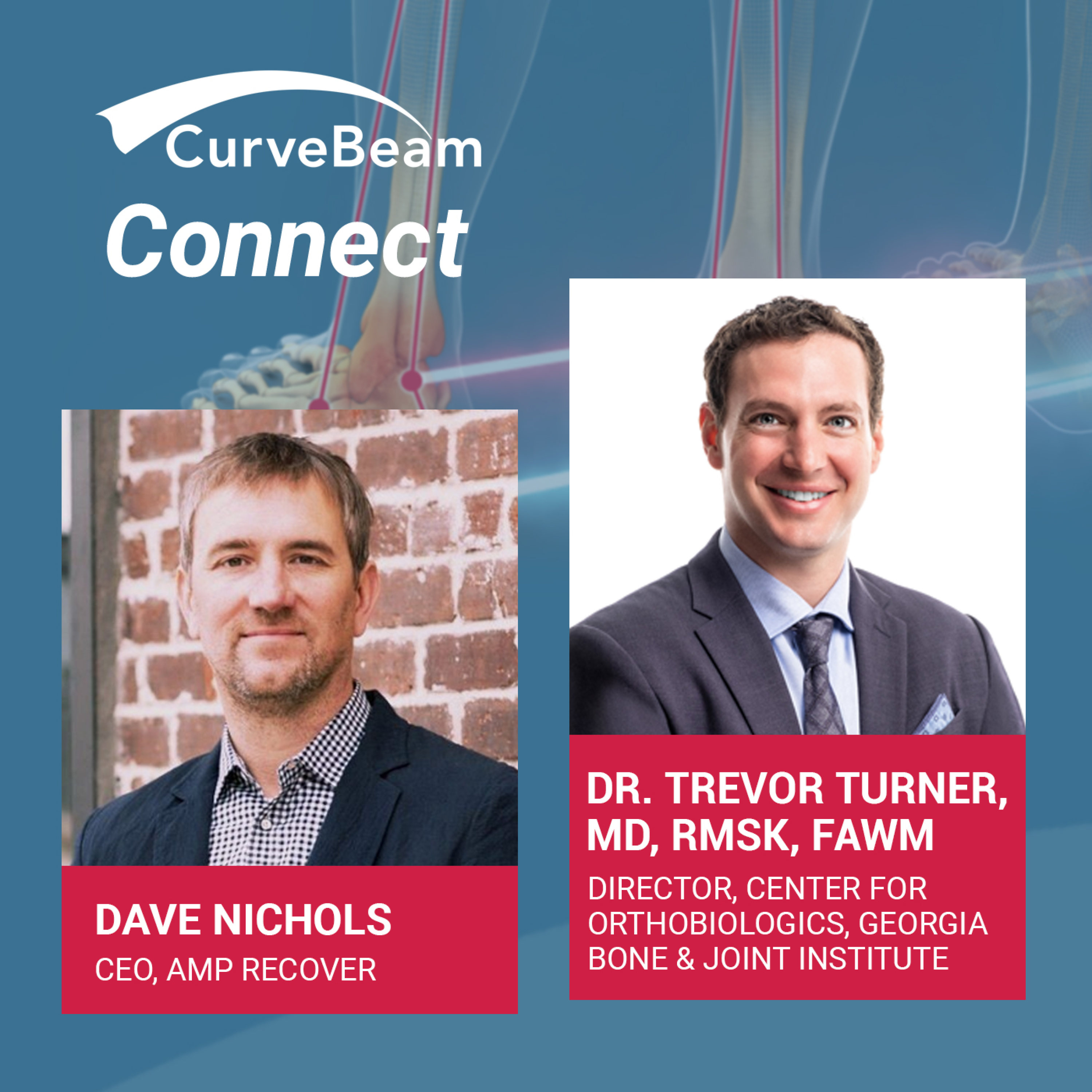 CurveBeam AI Cast