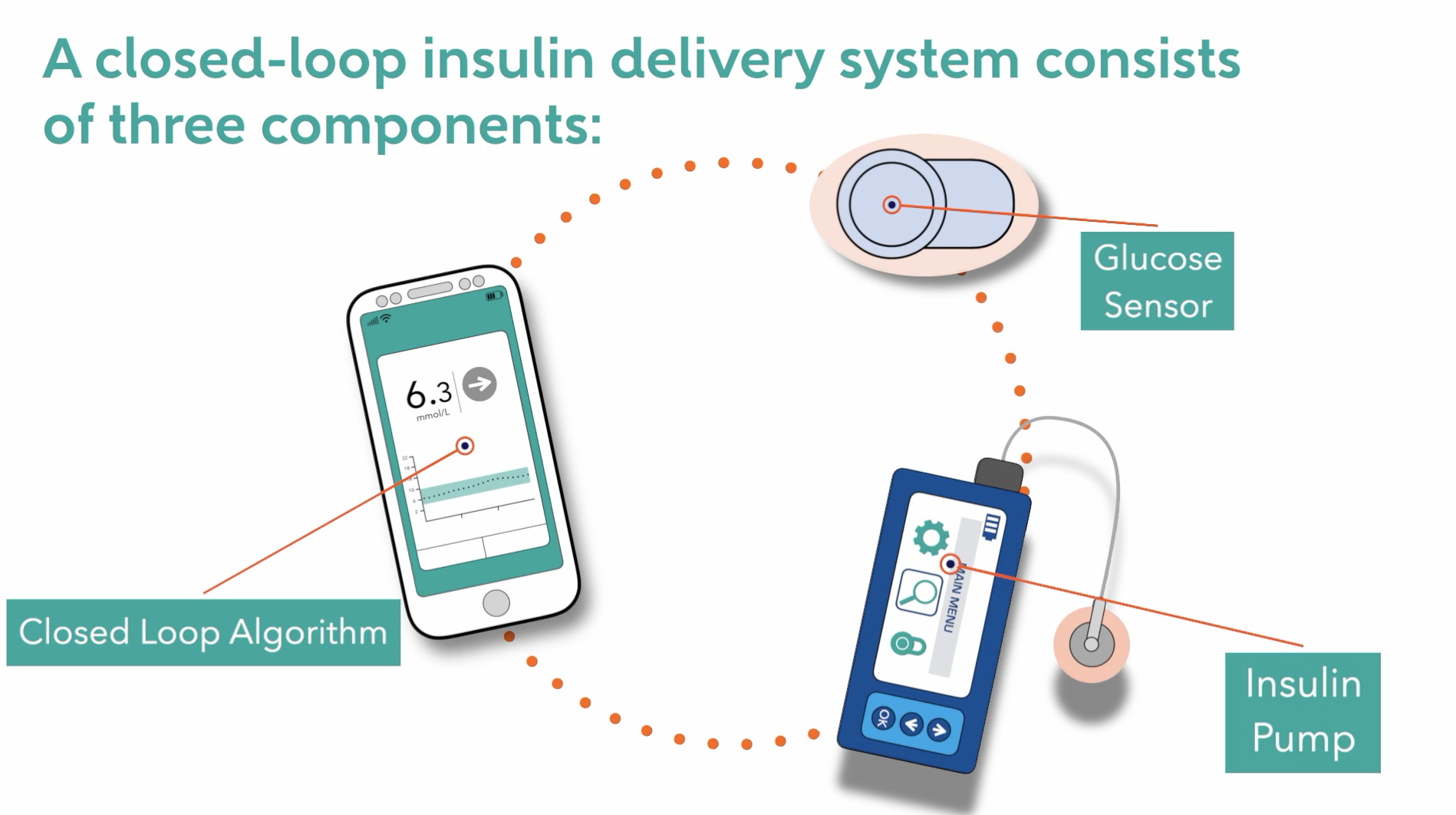 How Closed Loop Systems Work