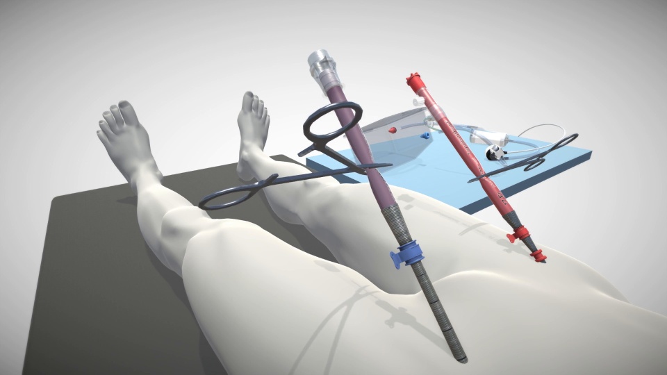 TandemLife VA Cannulation Animation video thumbnail
