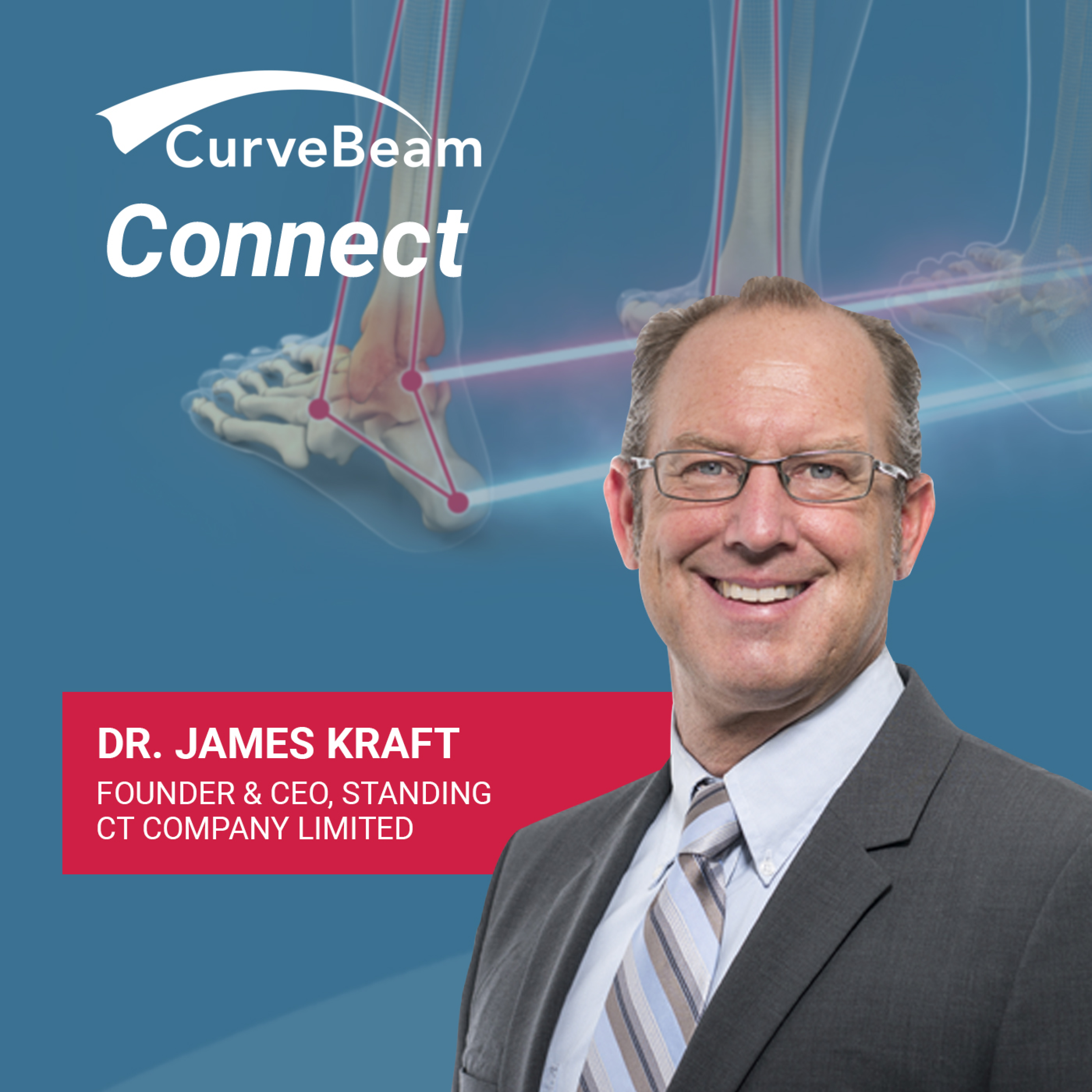 CurveBeam AI Cast