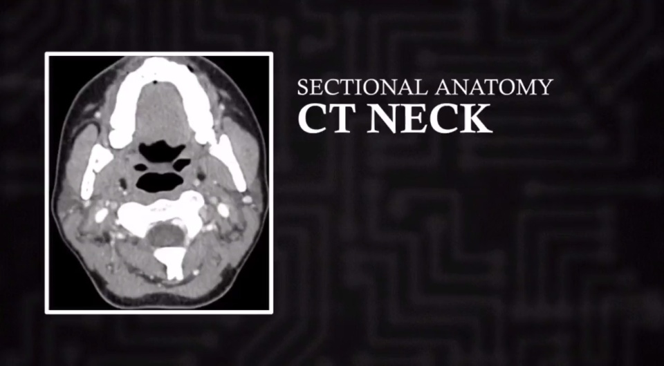 Ct Neck Axial Video Lesson Clover Learning