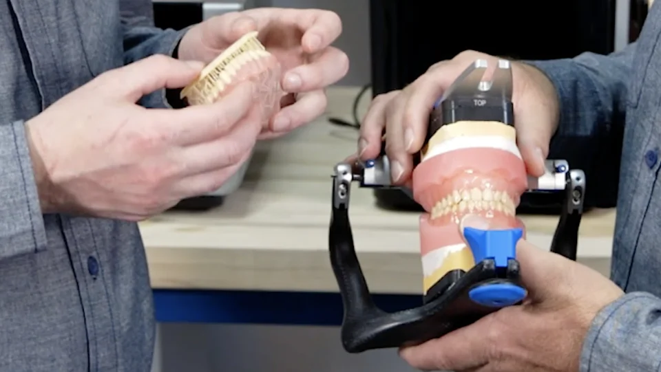 Réalisation d'une gouttière thermoformée par empreinte optique et  impression 3D – L'Information Dentaire