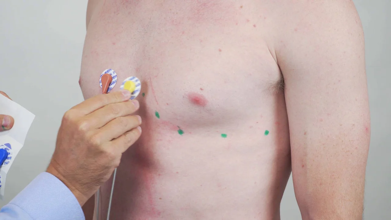 5 lead ecg placement