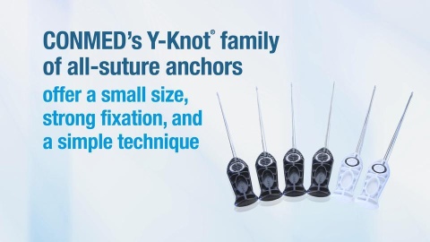 Y-Knot® All-Suture Anchor Family - Product Video