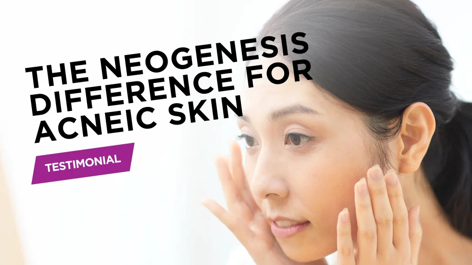 Hormonal Acne Transform Your Skin with Salicylic Acid Gel
