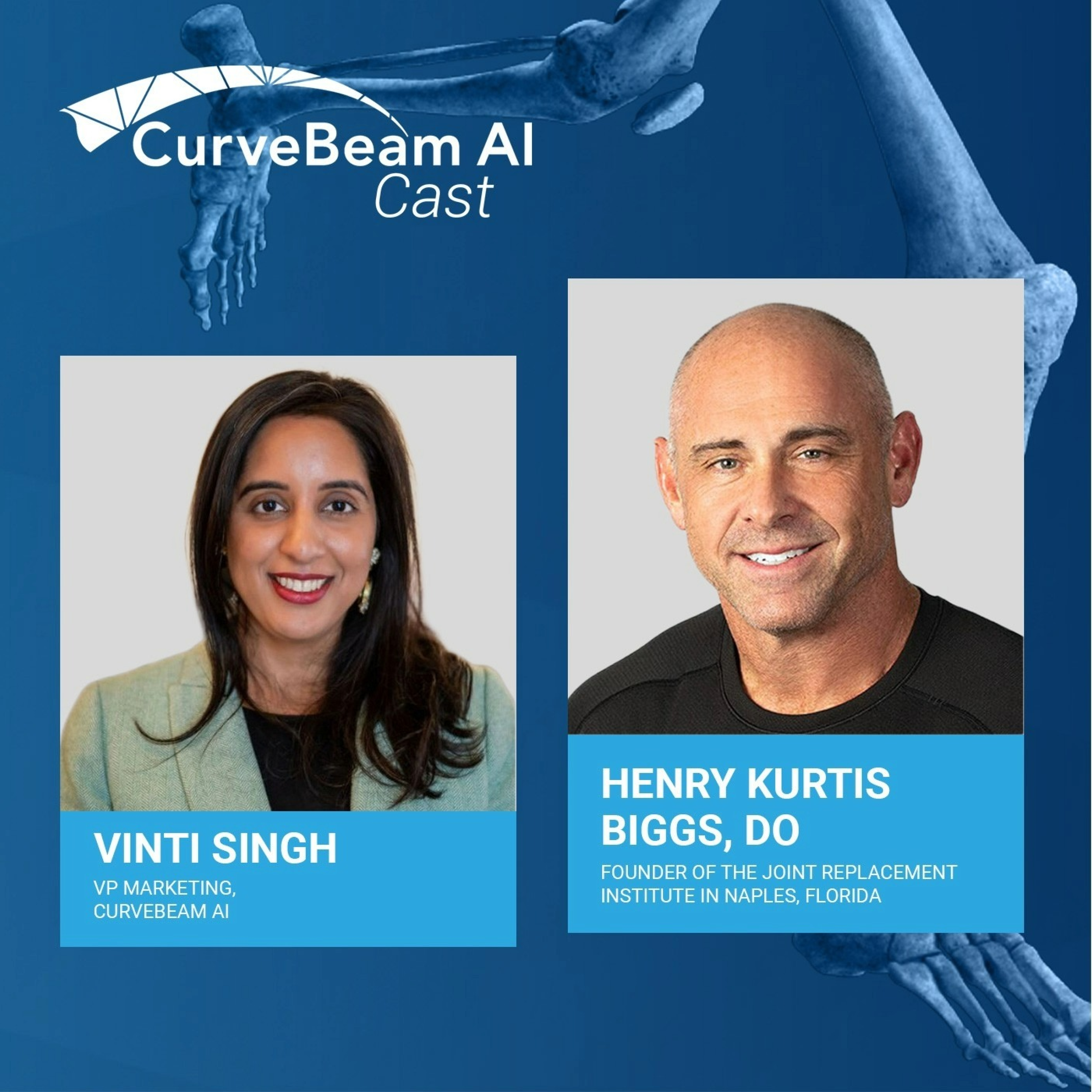 CurveBeam AI Cast