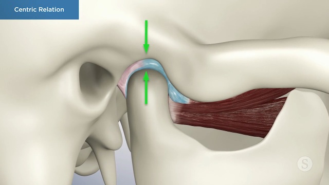 Centric Relation - Cosmetic Dentistry Centric Relation - Cosmetic Dentistry