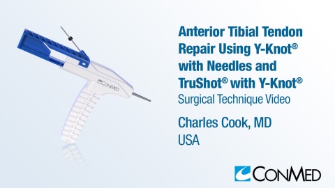 Dr. Cook - Anterior Tibial Tendon Repair Using Y-Knot® with Needles, TruShot® with Y-Knot®, and GENESYS Matryx®