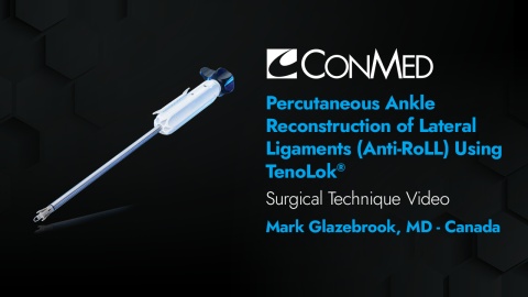 Dr. Glazebrook - Percutaneous Ankle Reconstruction of Lateral Ligaments (Percutaneous Anti-RoLL) Using TenoLok®