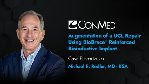 Dr. Redler Presentation (2025) - Augmentation of a UCL Repair Using BioBrace® Reinforced Biolnductive Implant