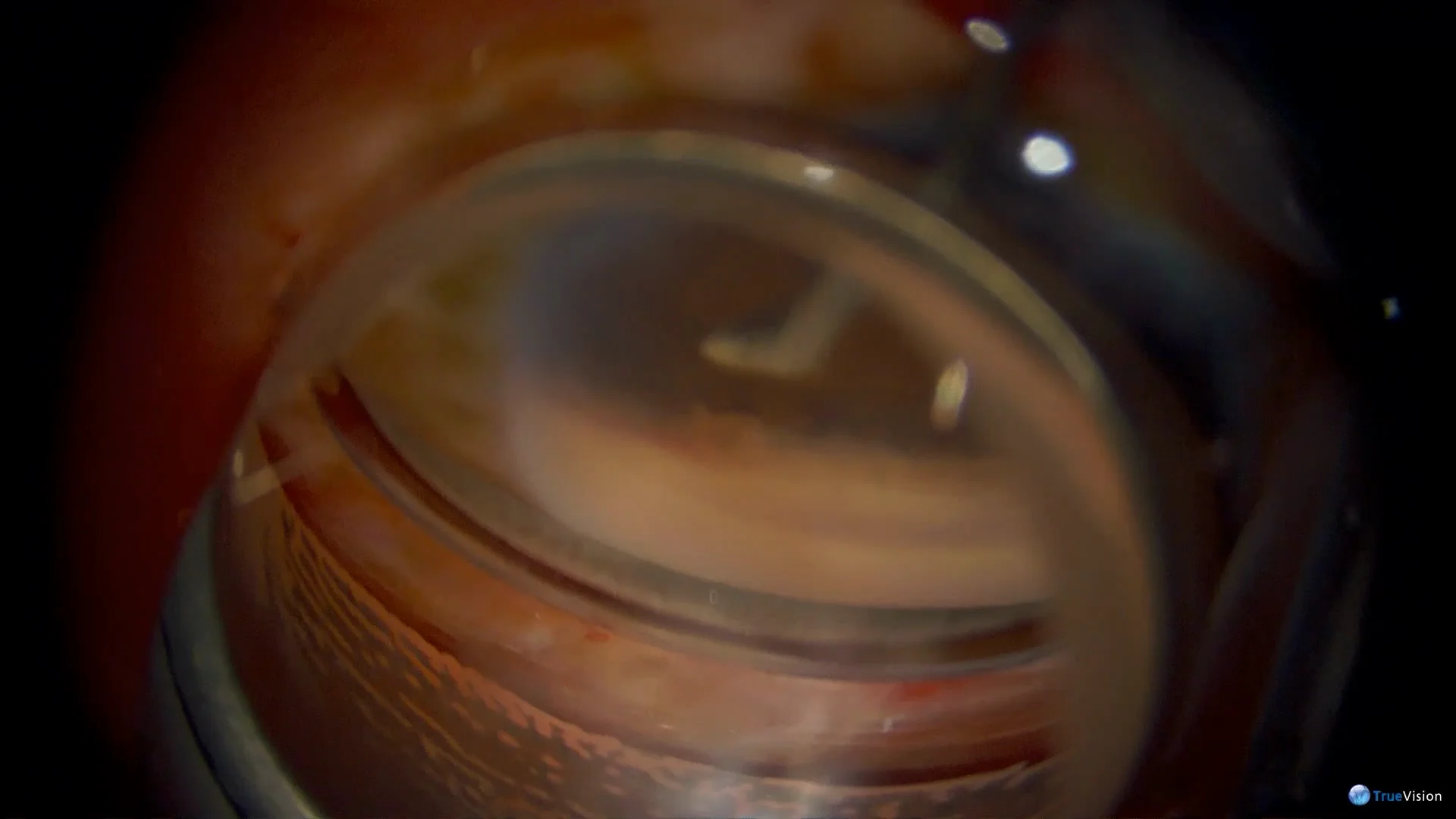 Alaris Capture Pro Software, image size:1920x1080