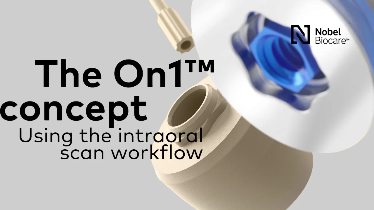 On1™ concept | Nobel Biocare