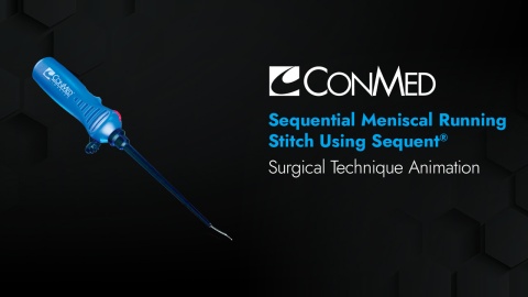 Sequential Meniscal Running Stitch Using Sequent®