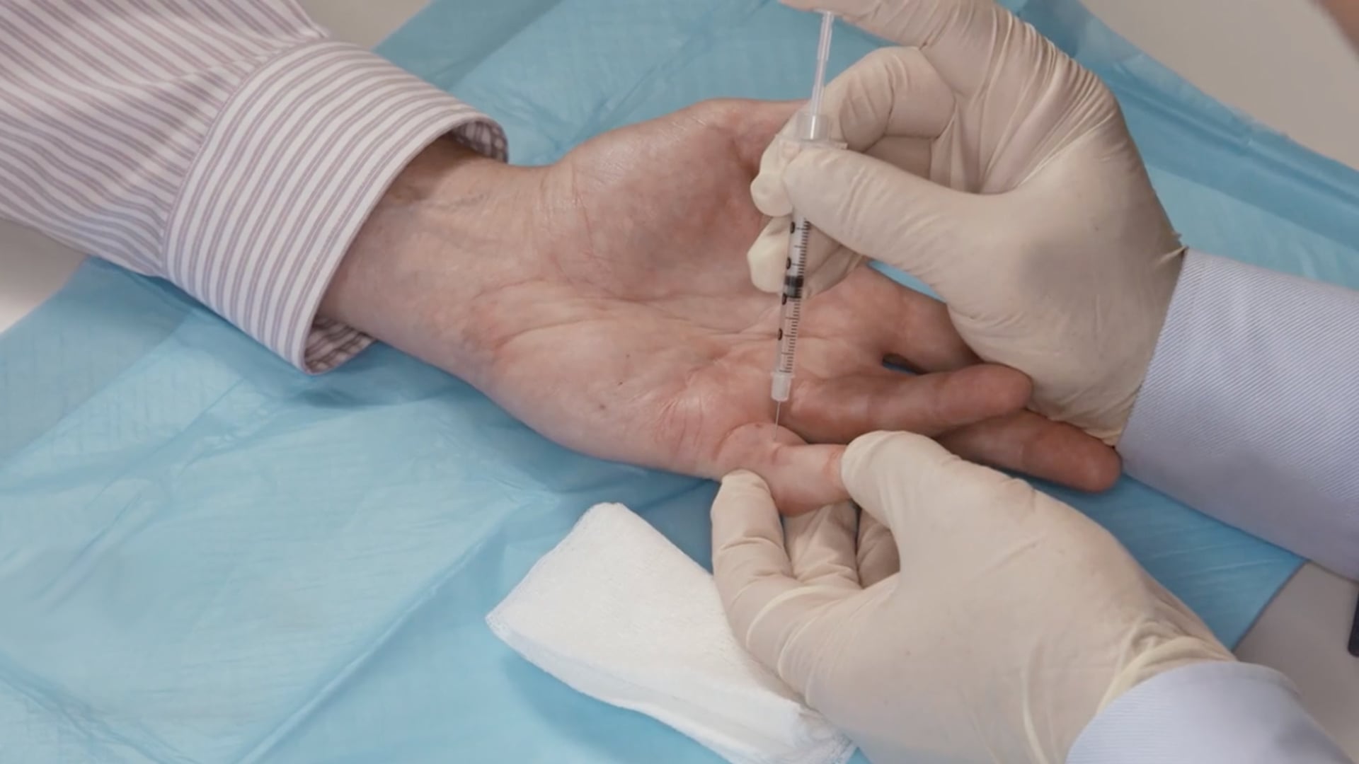 Jason Fanuele, MD: Single-joint fifth finger PIP 47° procedure video thumbnail