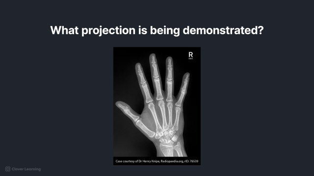 Hand Radiographic Anatomy Wikiradiography