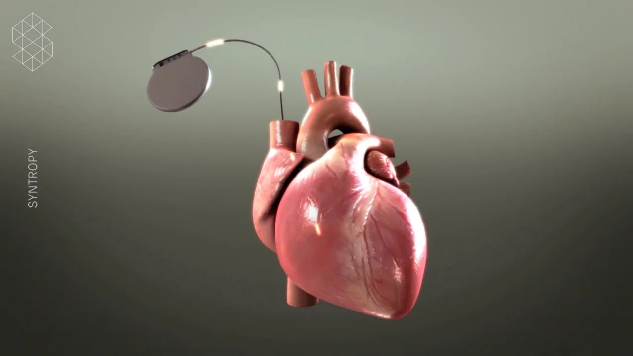Medical Animation Studio – Syntropy Medical Animation Studio – Syntropy