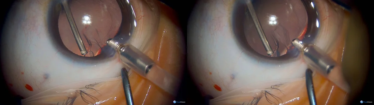 Wistia video thumbnail