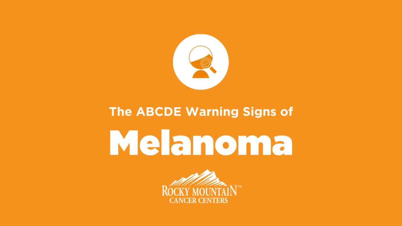 Warning Signs of Melanoma