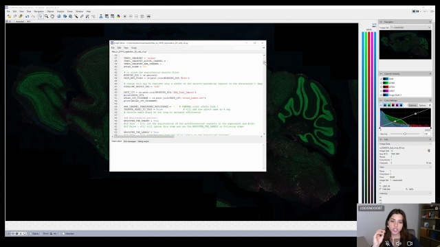 Tutorial: 2D Brain Atlas Registration in arivis Pro