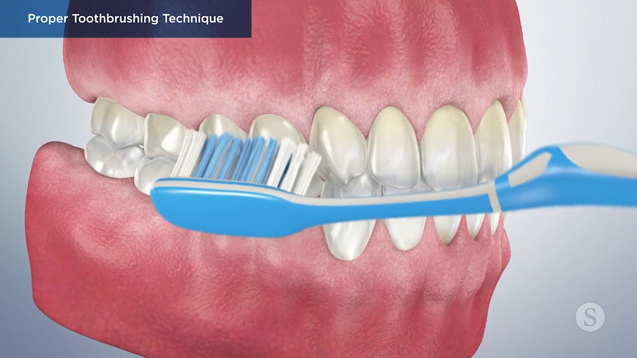 Proper tooth outlet brushing