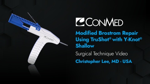 Dr. Lee - Brostrom Repair Using TruShot® with Y-Knot® Shallow