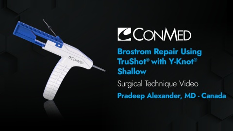 Dr. Alexander - Brostrom Repair Using TruShot® with Y-Knot® Shallow