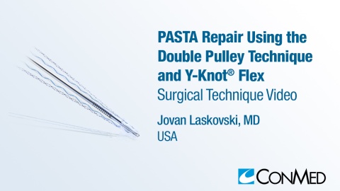 Dr. Laskovski - PASTA Repair Using the Double Pulley Technique and Y-Knot® Flex