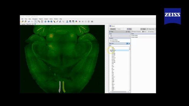 Master 3D atlas Registration with ZEISS arivis