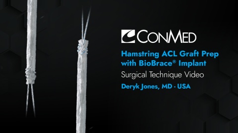 Dr. Jones - Hamstring ACL Graft Prep  with BioBrace® Augment